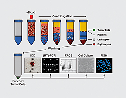 OncoQuick® Greiner Bio-One